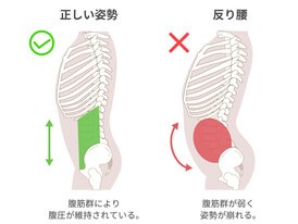 反り腰って？？？