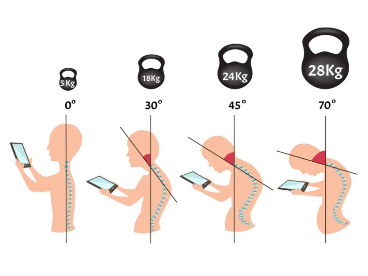 スマホ首の危険性！！