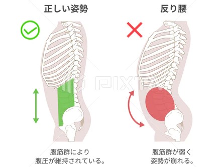 反り腰女子必見！！骨盤を整えて美しく過ごそう！